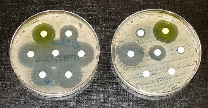 Antimicrobial-resistance