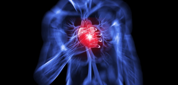 heart_attack