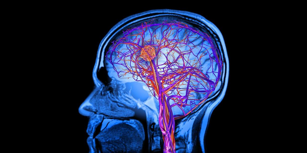 brain