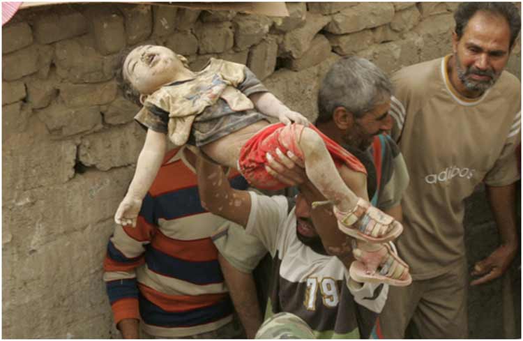 A dead Iraqi child, victim of the "Shock and Awe" attacks in Iraq