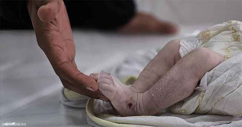 Newborn Baby Dies from Severe Cold in Gaza as Israel Blocks Entry of Adequate Tents and Caravans Amid Winter Storm