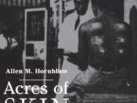 Acres of Skin—Human experiments At Holmesburg Prison