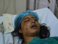 Kashmir: Pelleting Children To Blindness