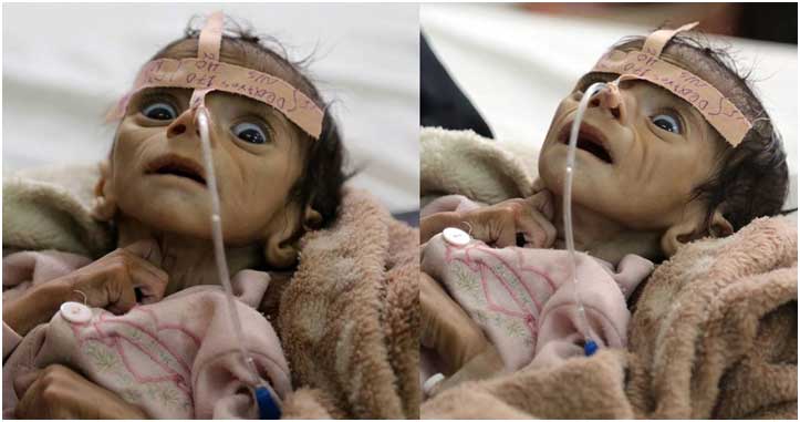 yemen child