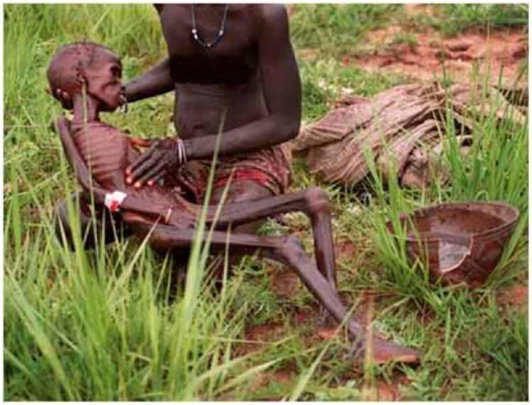 africa-starvation