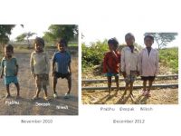 Fluorosis: A Problem of Serious  Dimensions, But Neglected By All Political  Parties