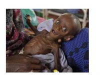  CIA Controlled Media Heartlessly Not Reporting Years of US War Causing Starvation Death in Somalia