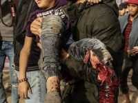 Abdul Rahman Nofal, 11, Gaza war-zone, was shot with an explosive bullet by a Jewish sniper and his leg was amputated. 19-4-18. Abdul loved playing football.