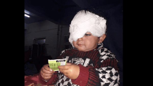 Hiba 18 months old pellet victim of Kashmir