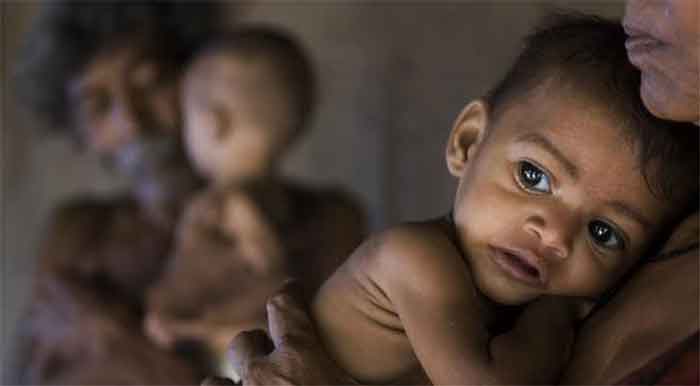 malnutrition hunger