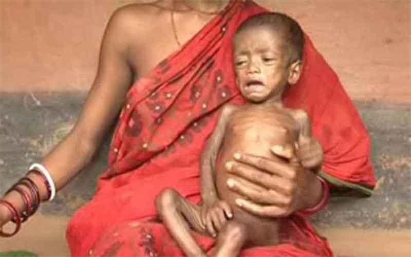 Malnutrition Odisha